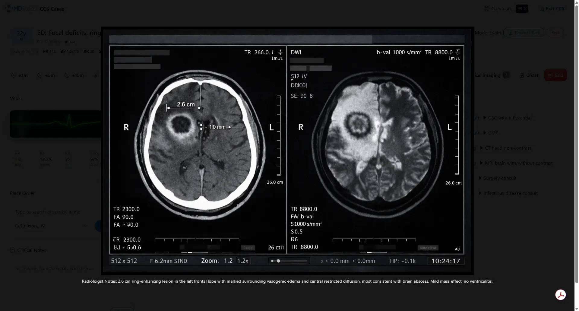 MDSteps CCS case screen showing imaging results, consult updates, and new clinical information during a case