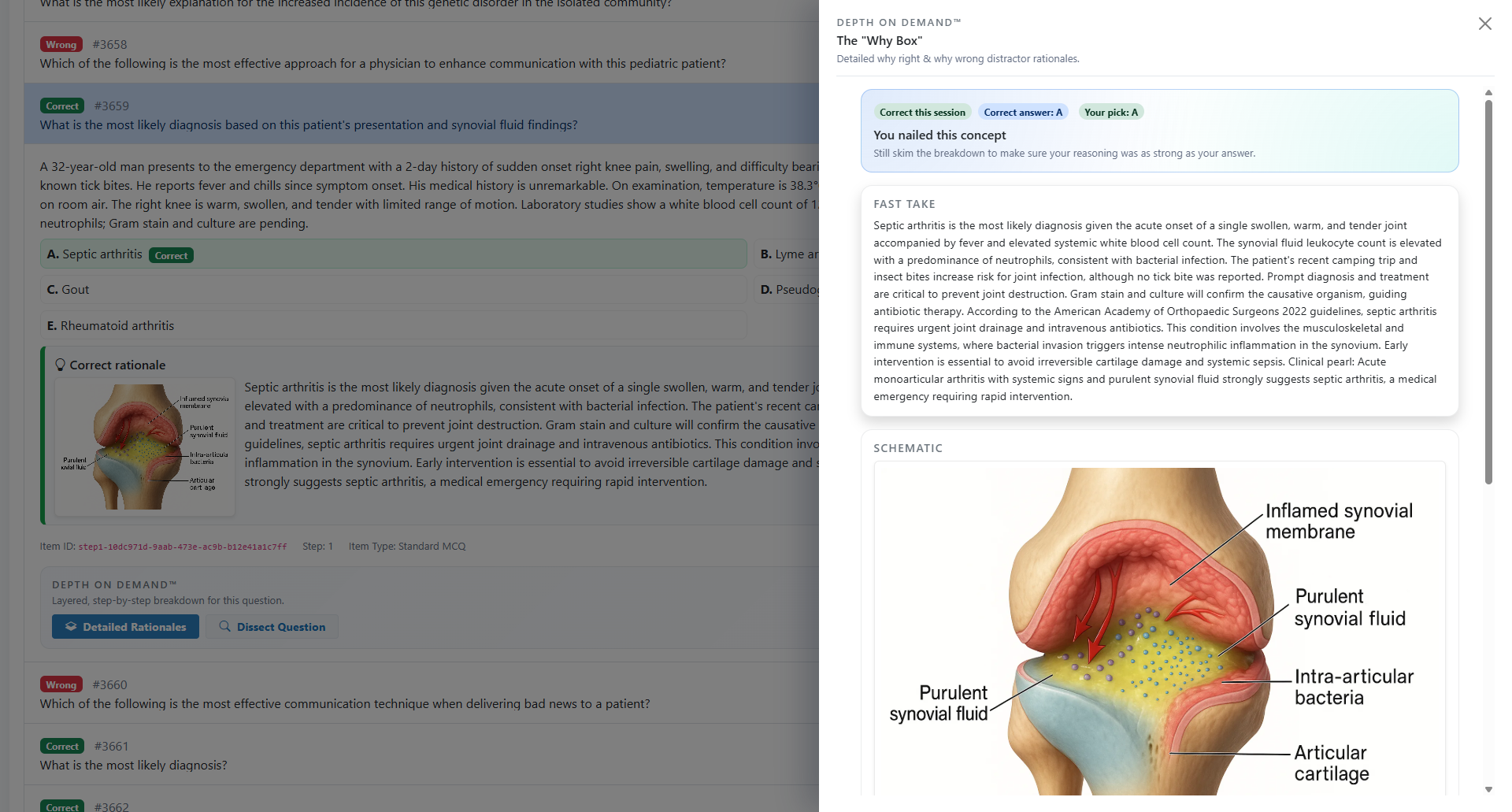 Depth on Demaind USMLE Question Review